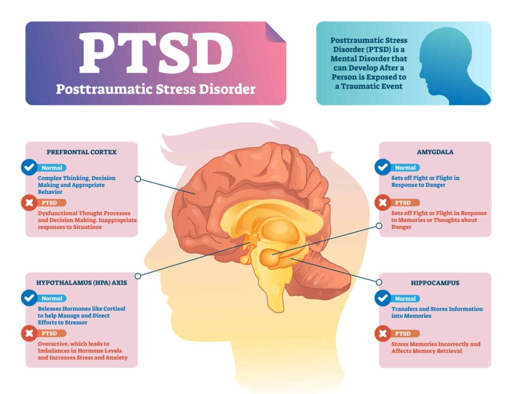 Post Traumatic Stress Disorder (PTSD)